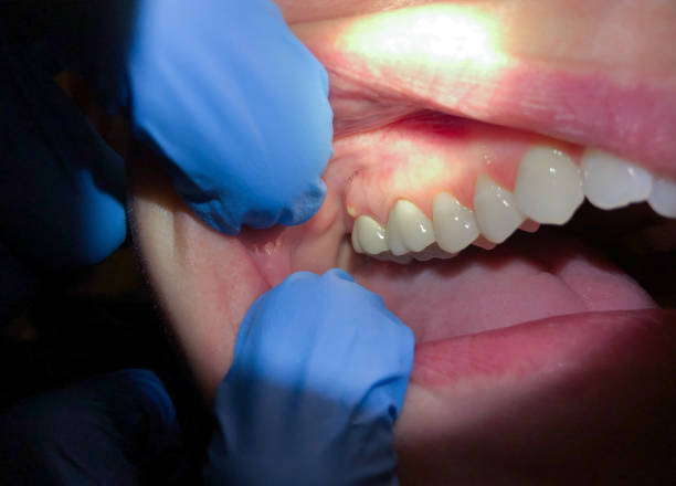 Best Orthodontic Emergency Dentist in Lake Success, NY